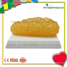 2lbs anotomical fat model